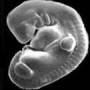 human_embryo.jpg